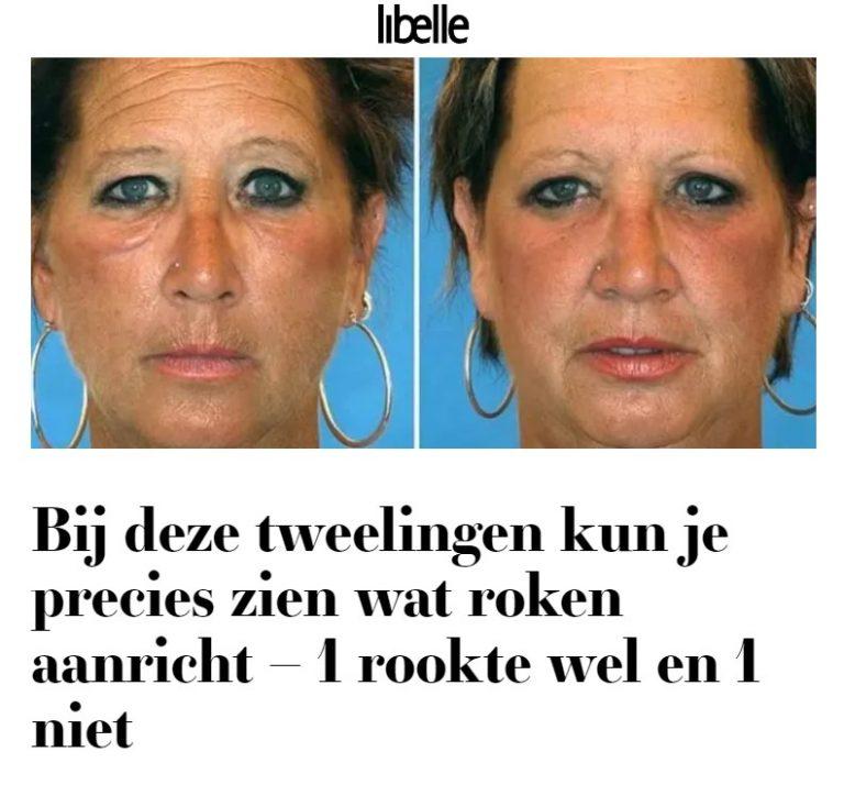Waarom is roken slecht voor je huid? Waarom is roken slecht voor je huid?
